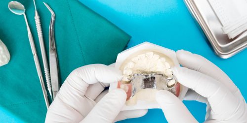 Flexible Partial Denture in Blue Background