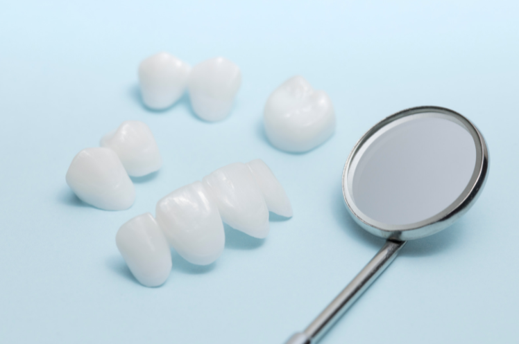 Clip-On Veneers: A Buyer and User’s Guide