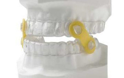 How does the anti-snoring device work?