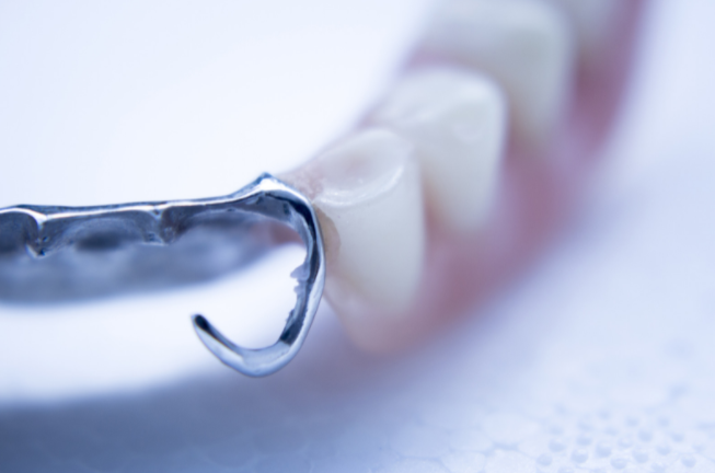 What Do Flexible Partial Dentures Look Like?