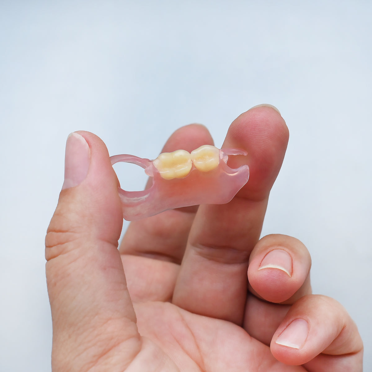 Nesbit (Unilateral) Partial Denture Flipper