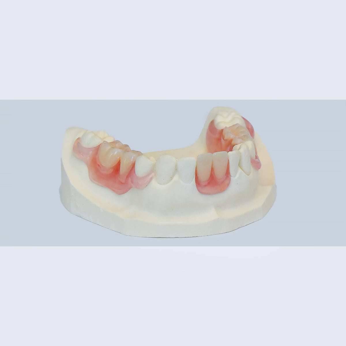 Flexible Partial Denture