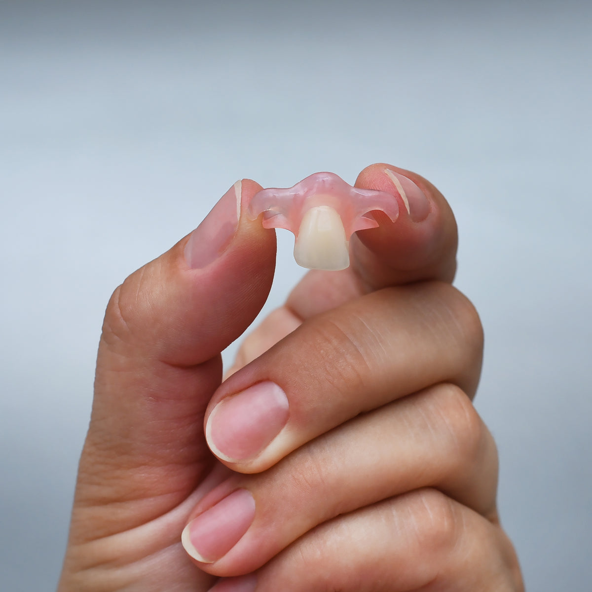 Nesbit (Unilateral) Partial Denture Flipper