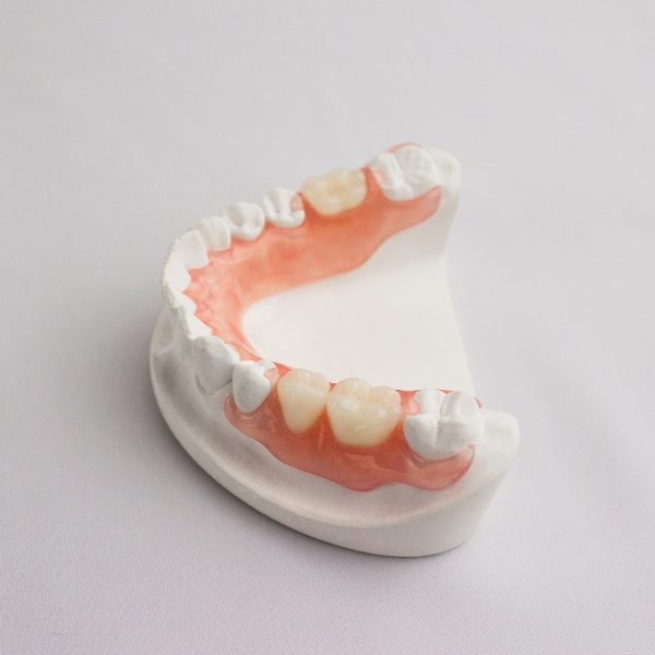 Flexible Partial Denture