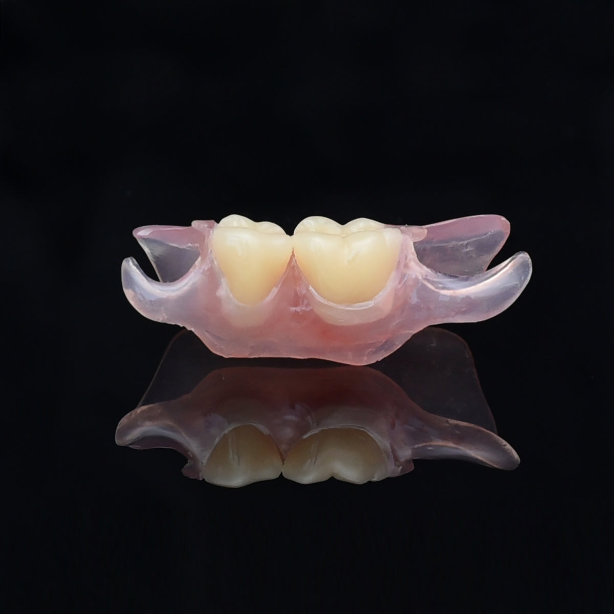 Nesbit (Unilateral) Partial Denture Flipper