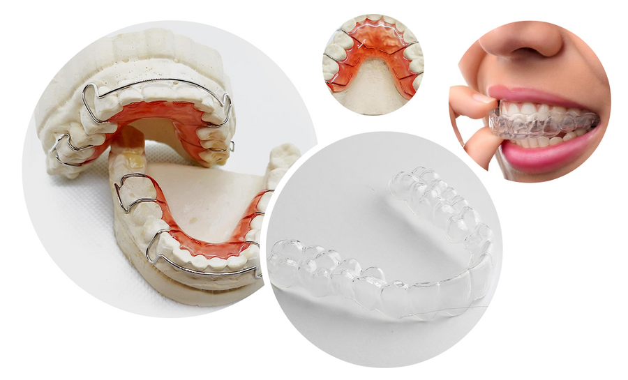 Collage of dental models, a mold, and a person wearing clear braces.