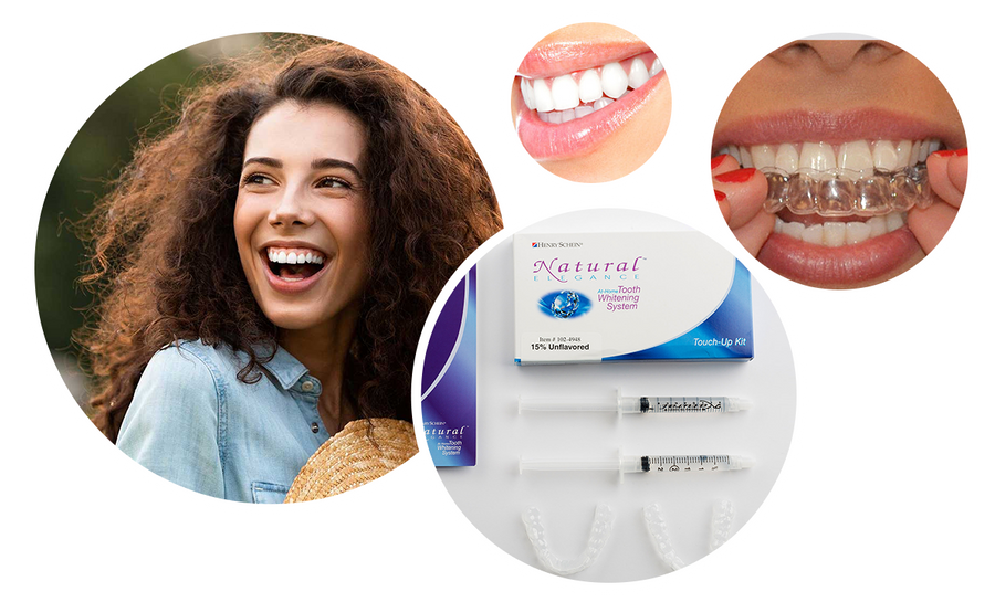 Collage of a woman smiling, close-up of teeth, and dental product packaging.