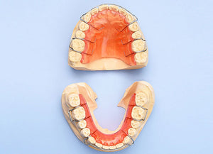 Hawley Retainer