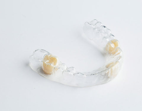 Essix Partial Denture Retainer