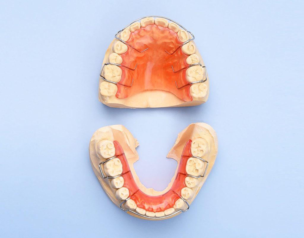 Hawley Orthodontic Retainer