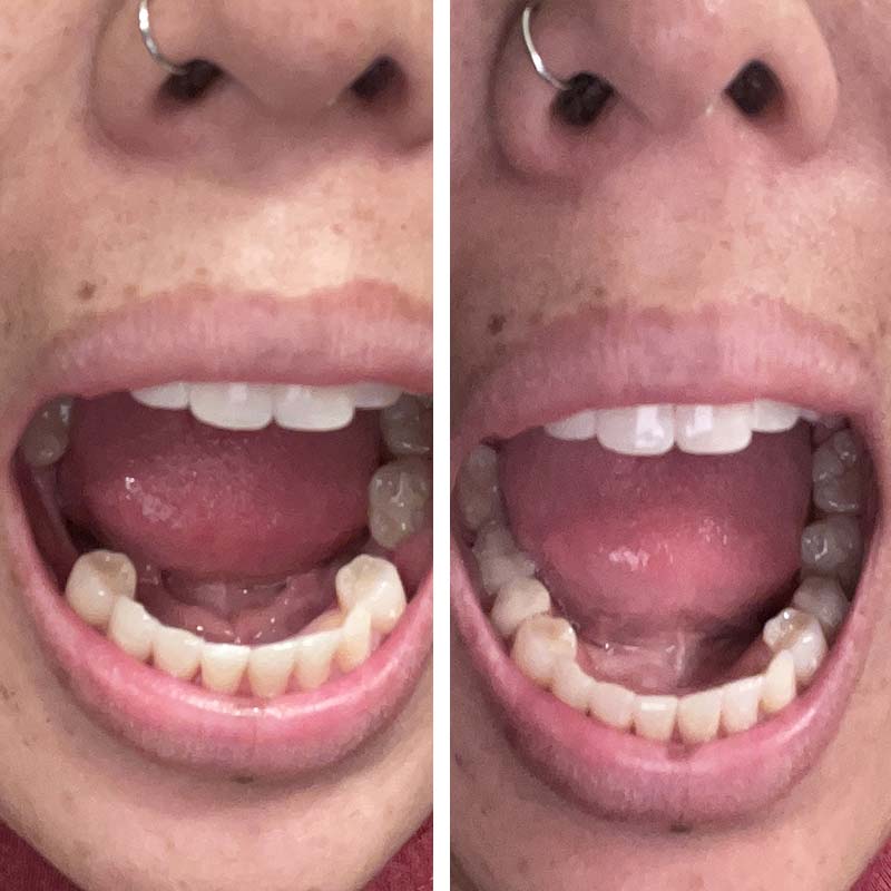 Krista S. / Oronogo, MO