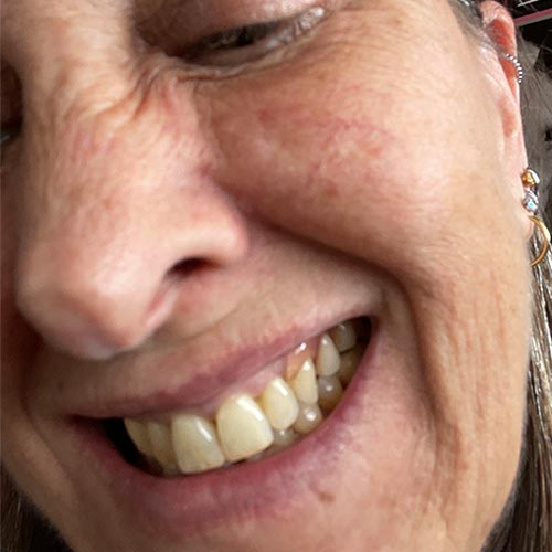 Doris G. / Davie, FL