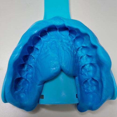 Dental Impression Kit With Putty Quick & Easy Teeth Mould and Cast Make  Your Own Upper Lower Tooth Mold at Home Custom DIY Mouth Model -   Finland