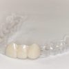 Retainer denture teeth Retenedor transparente