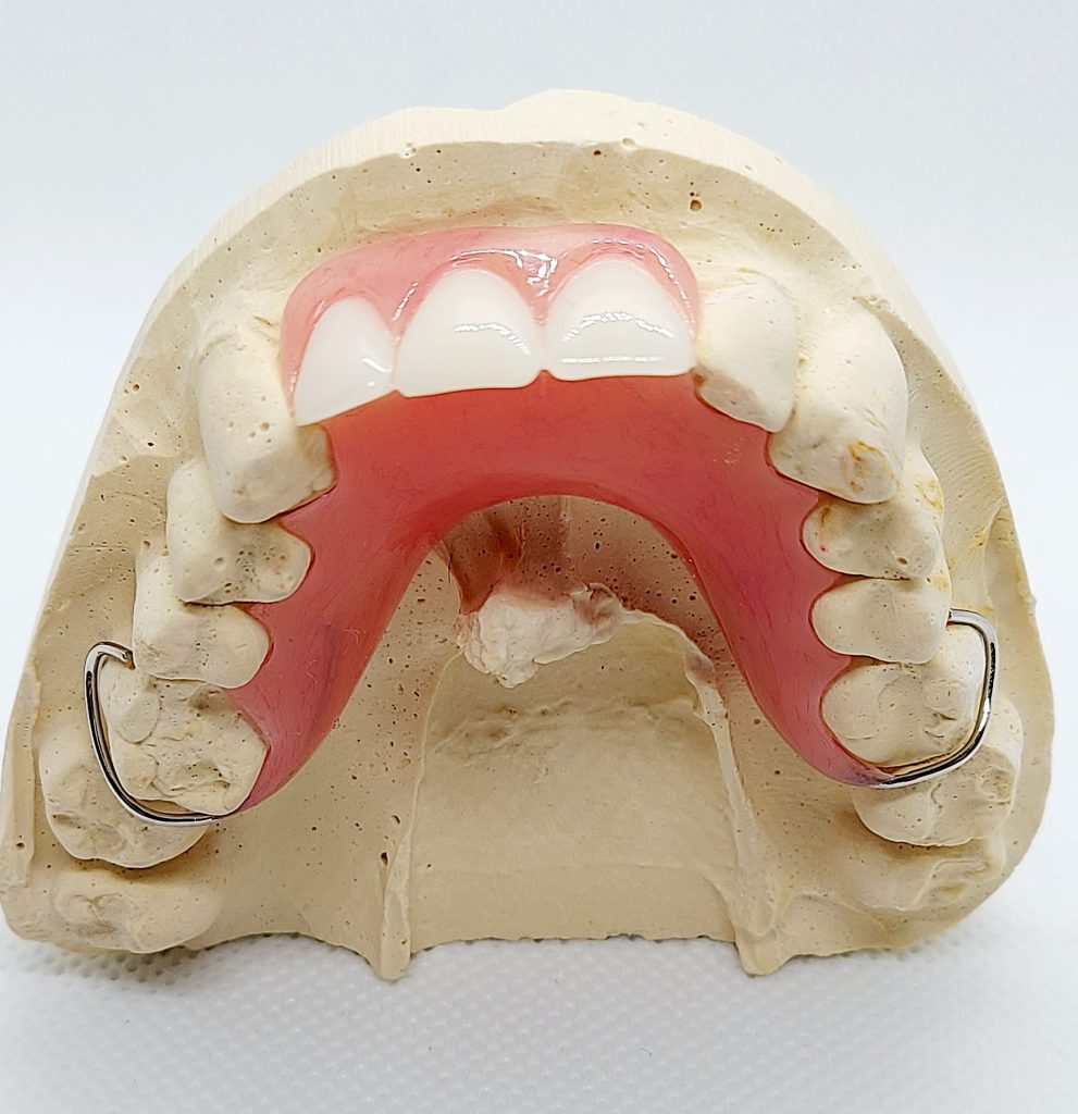 best material for dentures: acrylic dentures