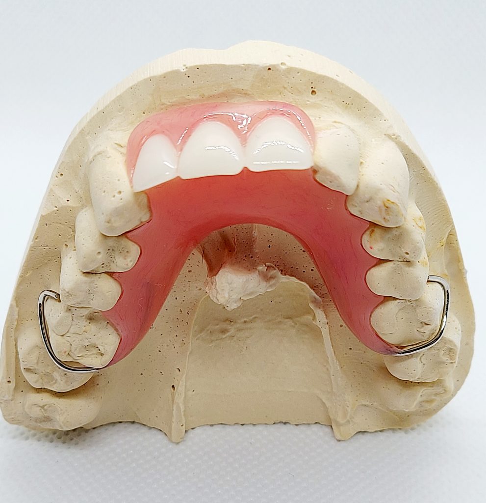 Partial Dentures with Metal Clasps Ultimate Guide to Better Smiles