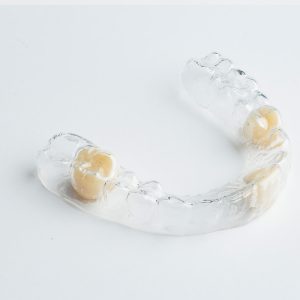 Clear Retainer Partial Dentures