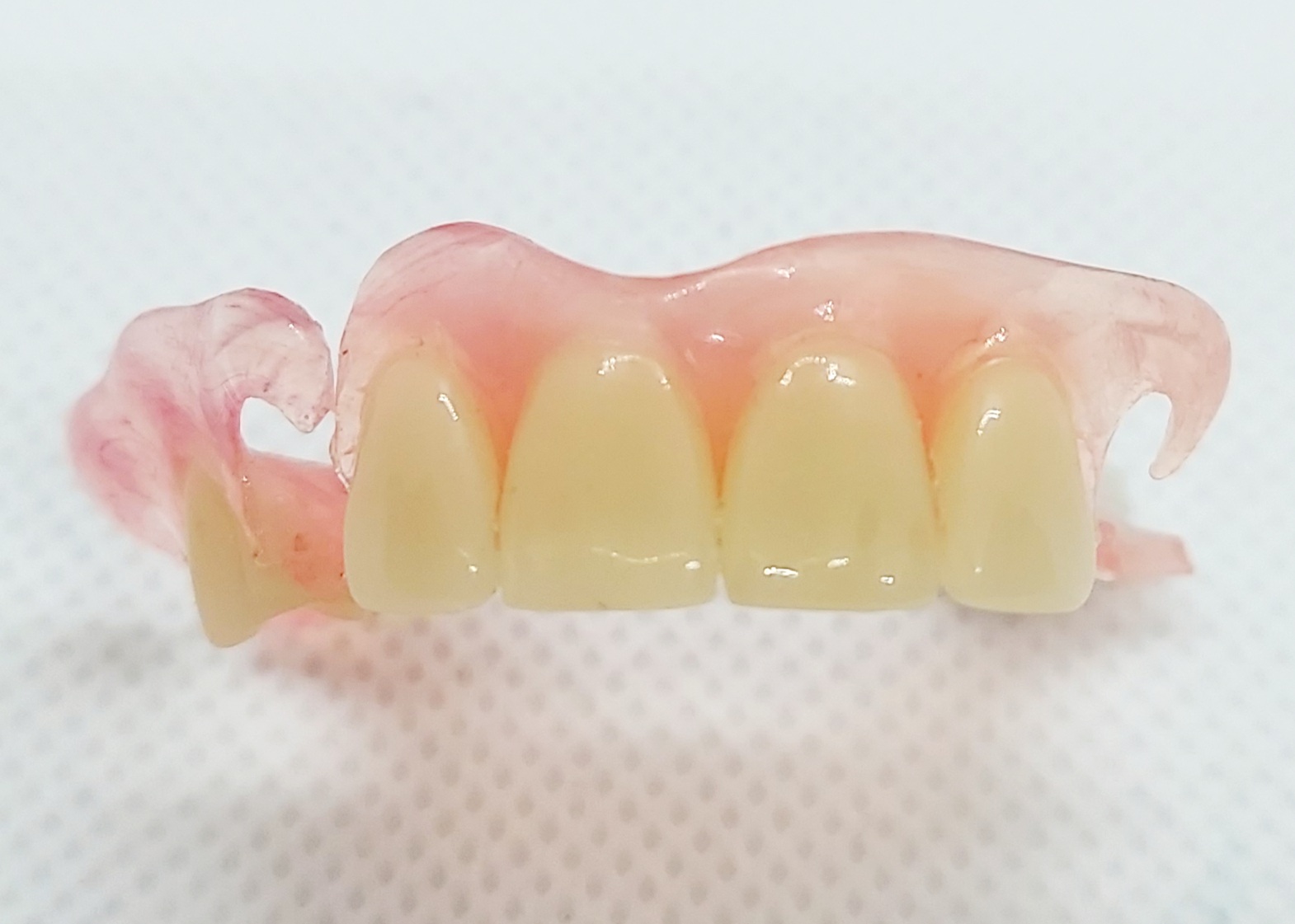 flexible-partial-dentures-dental-lab-direct