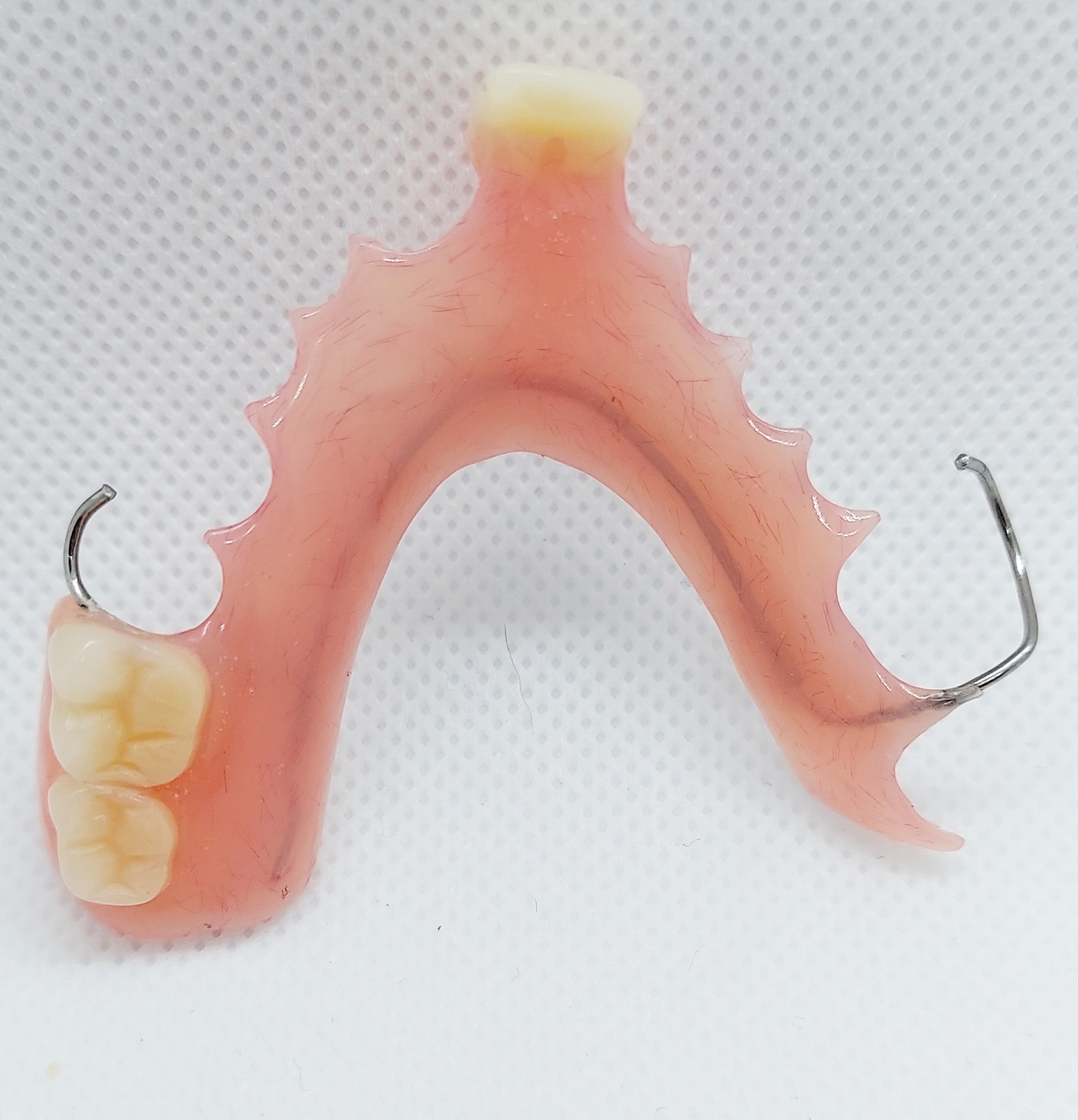 Acrylic Partial Denture Dental Lab Direct