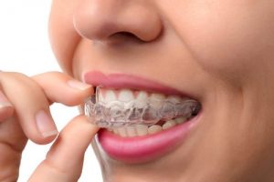 A lady fixing retainer tray in her mouth