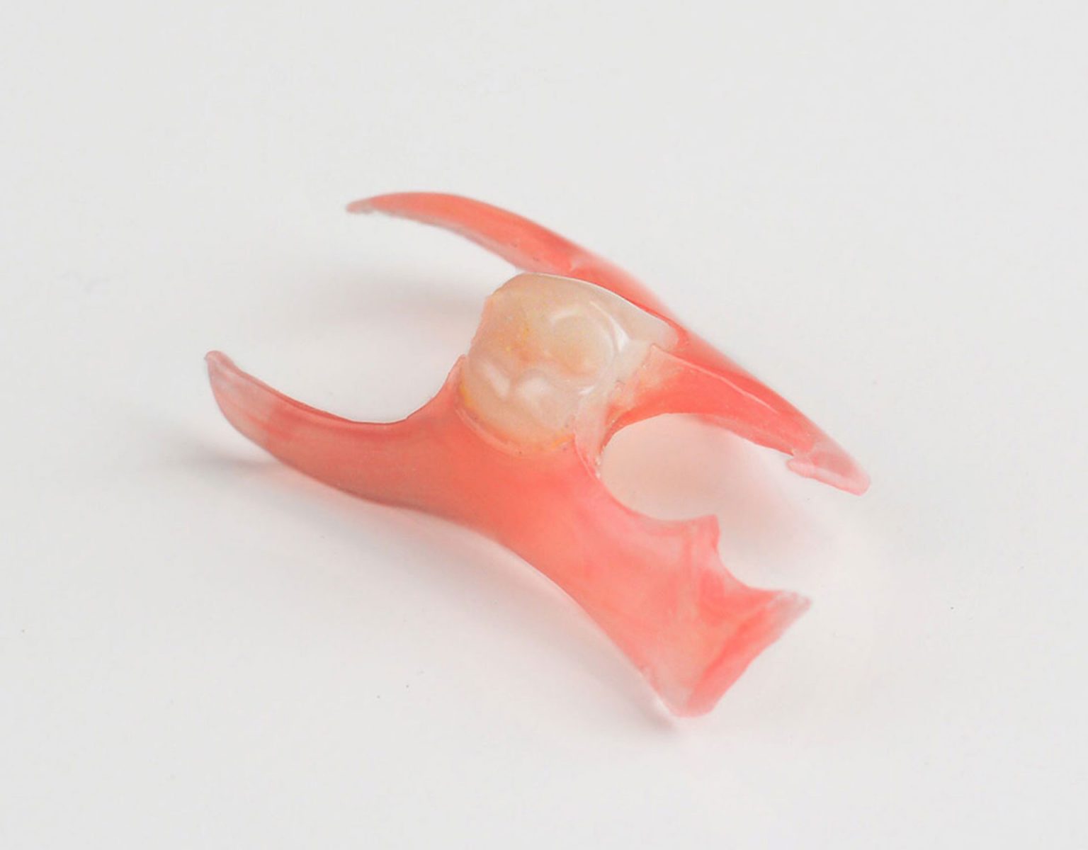 Nesbit Flexible Partial Denture – Dental Lab Direct