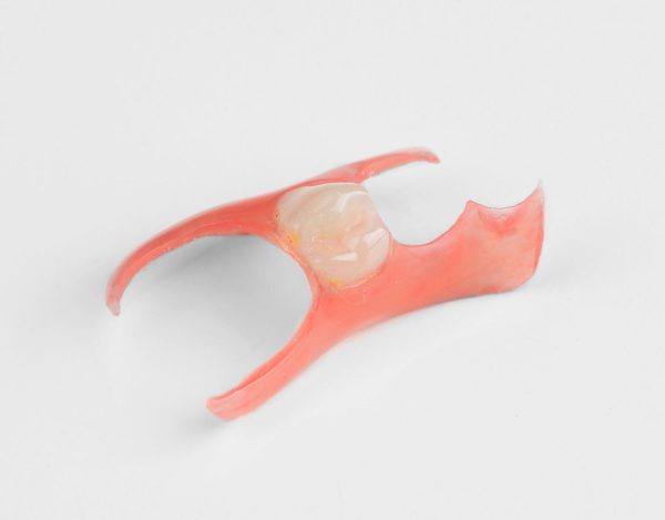 Nesbit Flexible Partial Denture