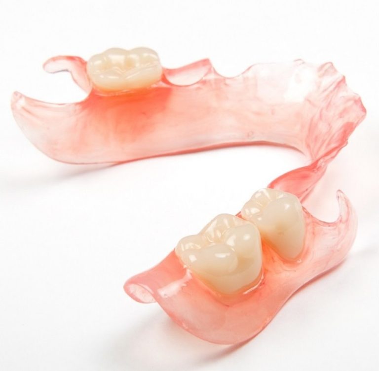 Benefits of using Metal-Free Dental Appliances - Dental Lab Direct