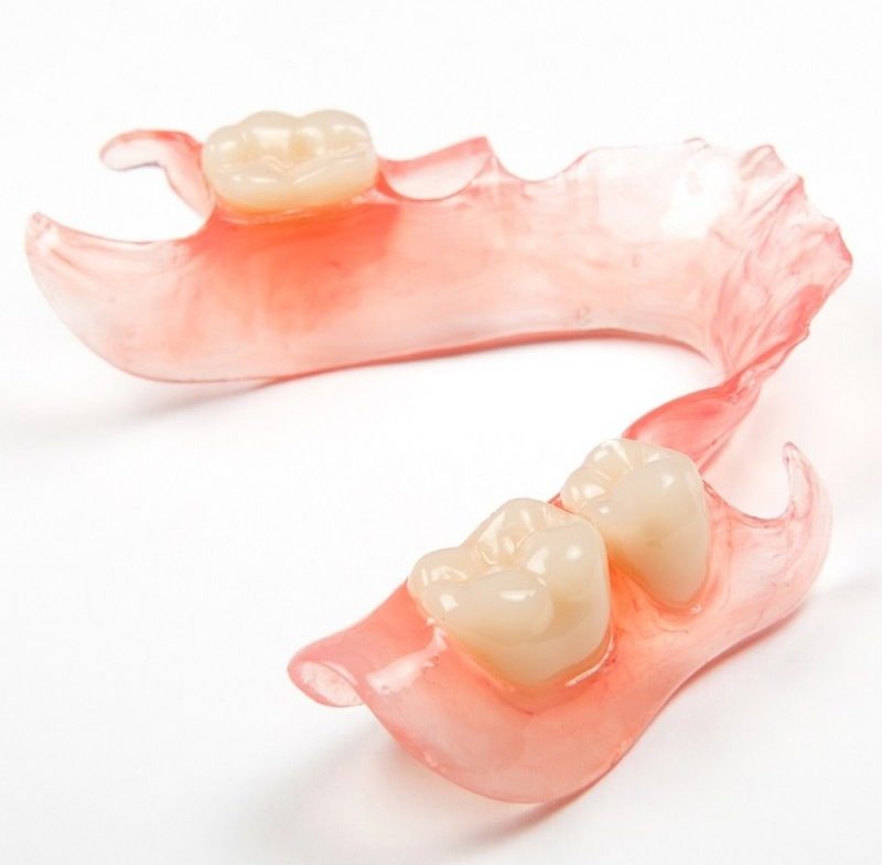 flexible partial denture