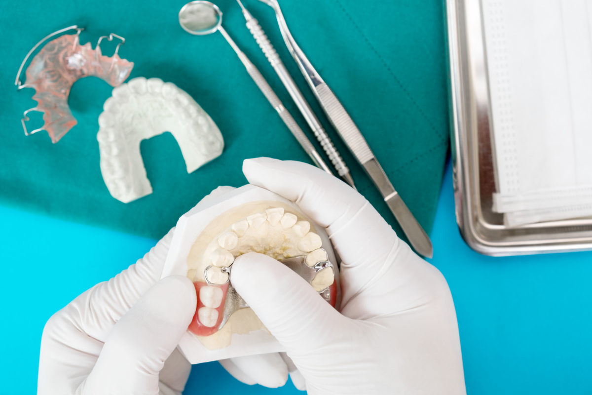 artificial removable partial denture temporary partial denture blue ground 5 Advantages of Mail-Order Partial Dentures