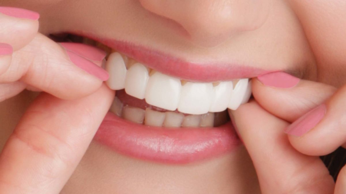 A lady with a beautiful clip-on smile