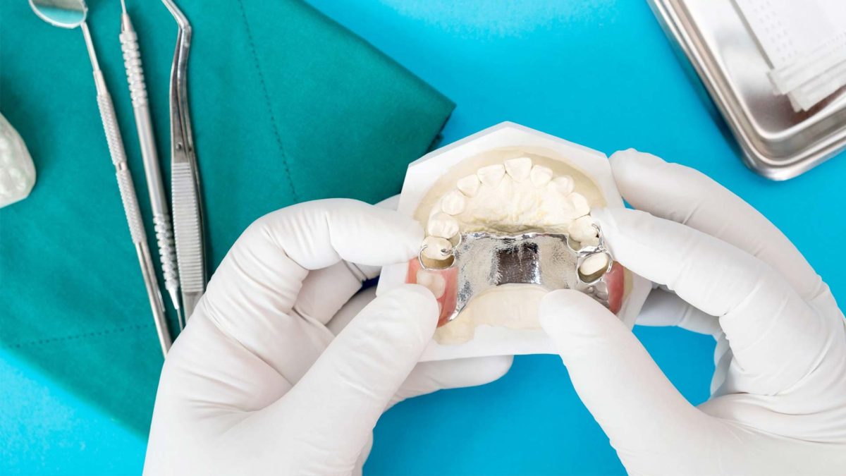 Dentist checking partial dentures