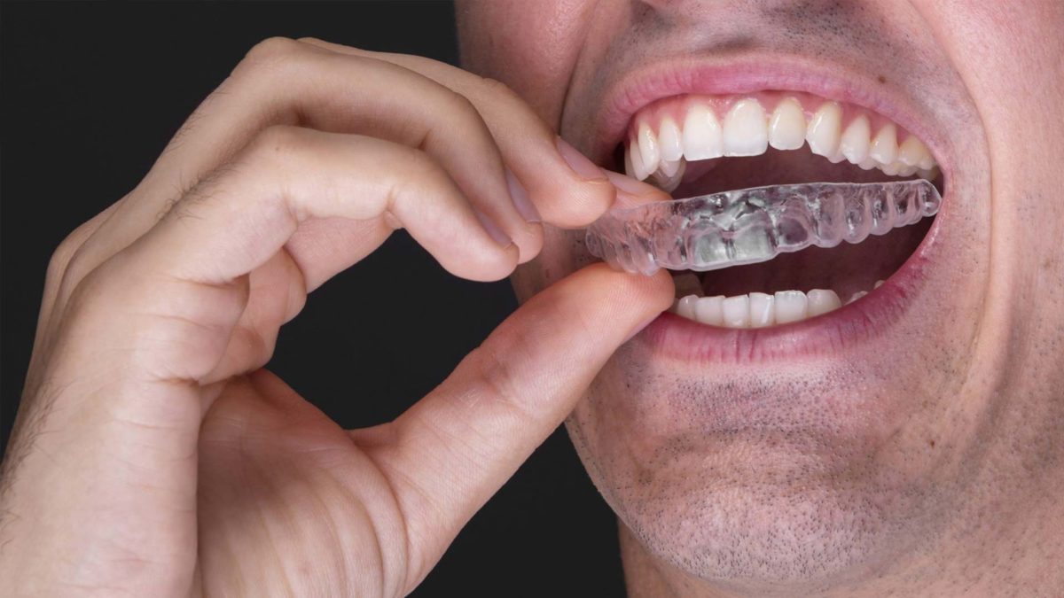 Clear custom mouth guard being held