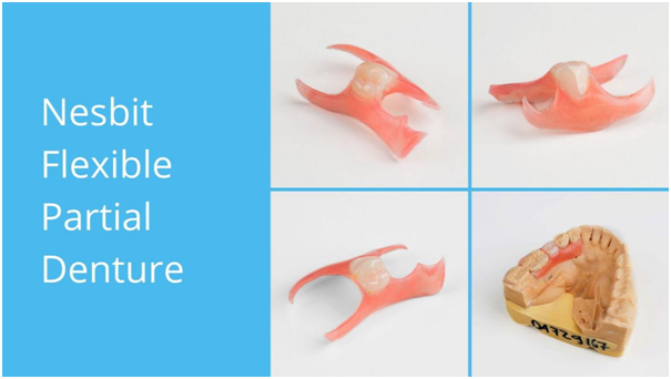 5 Advantages of Nesbit Flexible Partial Denture from Dental Lab Direct 5 Advantages of Nesbit Flexible Partial Denture from Dental Lab Direct