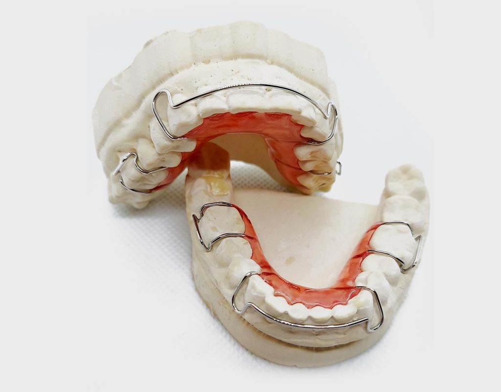 Buy Hawley Orthodontic Retainers Dental Lab Direct