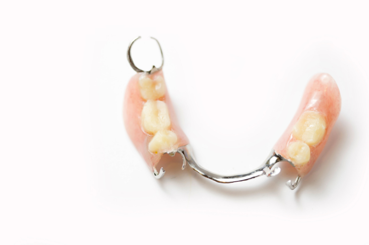 an acrylic partial denture with metal clasps against a white background