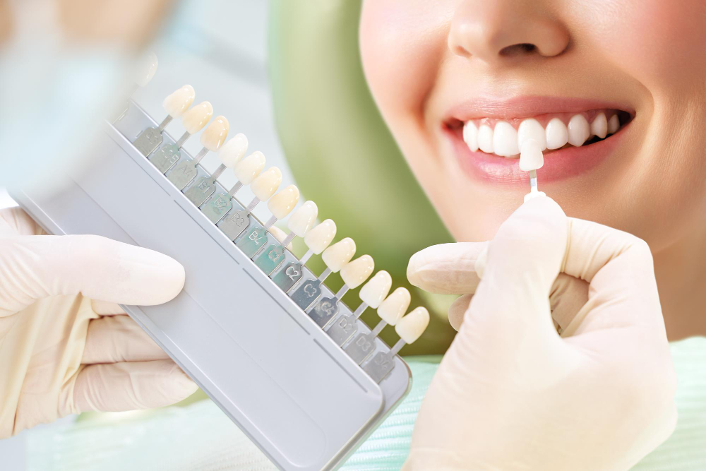 The Importance of Choosing the Right Type of Veneers for Your Teeth