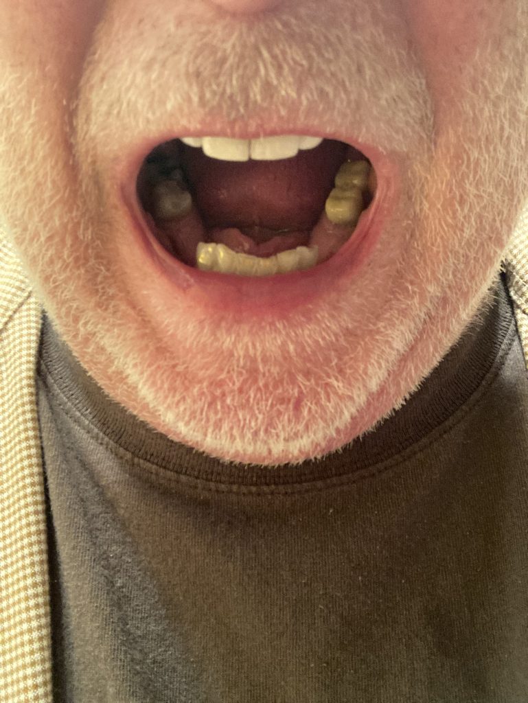 Image #2 from Dennis