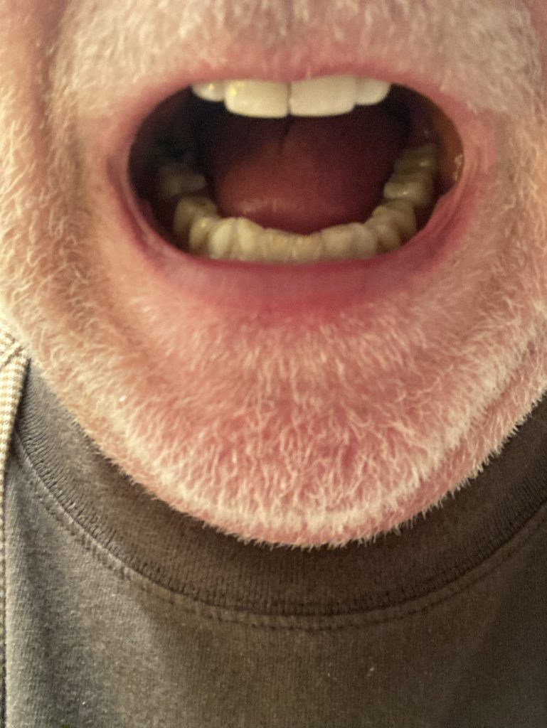 Image #1 from Dennis