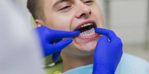 Dentist fixing retainers to patient