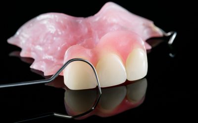 Dental prosthetic isolatic - partial denture upper side.